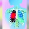 13-year-old girl swallows pin, docs retrieve it from her lung | India News